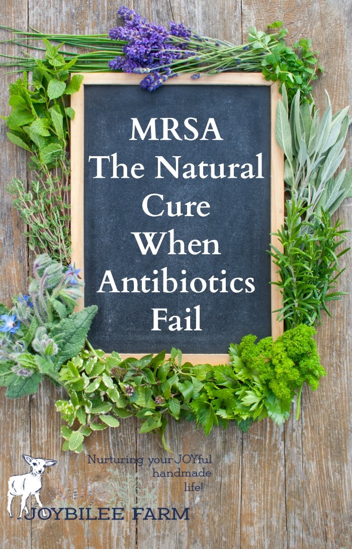 This MRSA natural cure is easy to use at home, without antibiotics, using herbs, essential oil, and other natural remedies that you might already have at home. These 10 natural remedies will give you the best chance to stop a MRSA infection so you can get back to doing the things you love.