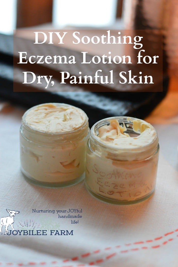 This herbal eczema cream is rich in moisturizing oils and nourishing botanicals that hydrate the tissues, as well as botanicals and probiotics to nourish the skin encouraging normal cell growth. While you can use this as an eczema cream, it isn’t a medicated lotion. This is safe to use for any skin issue that needs a little extra moisture.