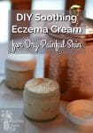 Jars of homemade eczema cream